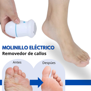 MOLINILLO ELECTRICO DE PIE REMOVEDOR DE CALLOS